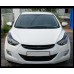 ARTX - LUXURY CARBON TUNING GRILL HYUNDAI AVANTE / ELANTRA 2010-13