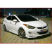 SEQUENCE QUANTUM EDITION KIT FOR HYUNDAI AVANTE MD ELANTRA 2010-13