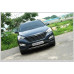 ARTX LUXURY CARBON TUNING GRILLE SET HYUNDAI SANTA FE DM 2012-15 ARTX LUXURY CARBON TUNING GRILLE SET HYUNDAI SANTA FE DM 2012-15